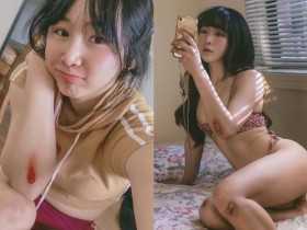 【万博娱乐】「機機Shacy」受傷不忘放曬火辣美體,「渾圓蜜臀」讓男粉邊心疼邊享受!